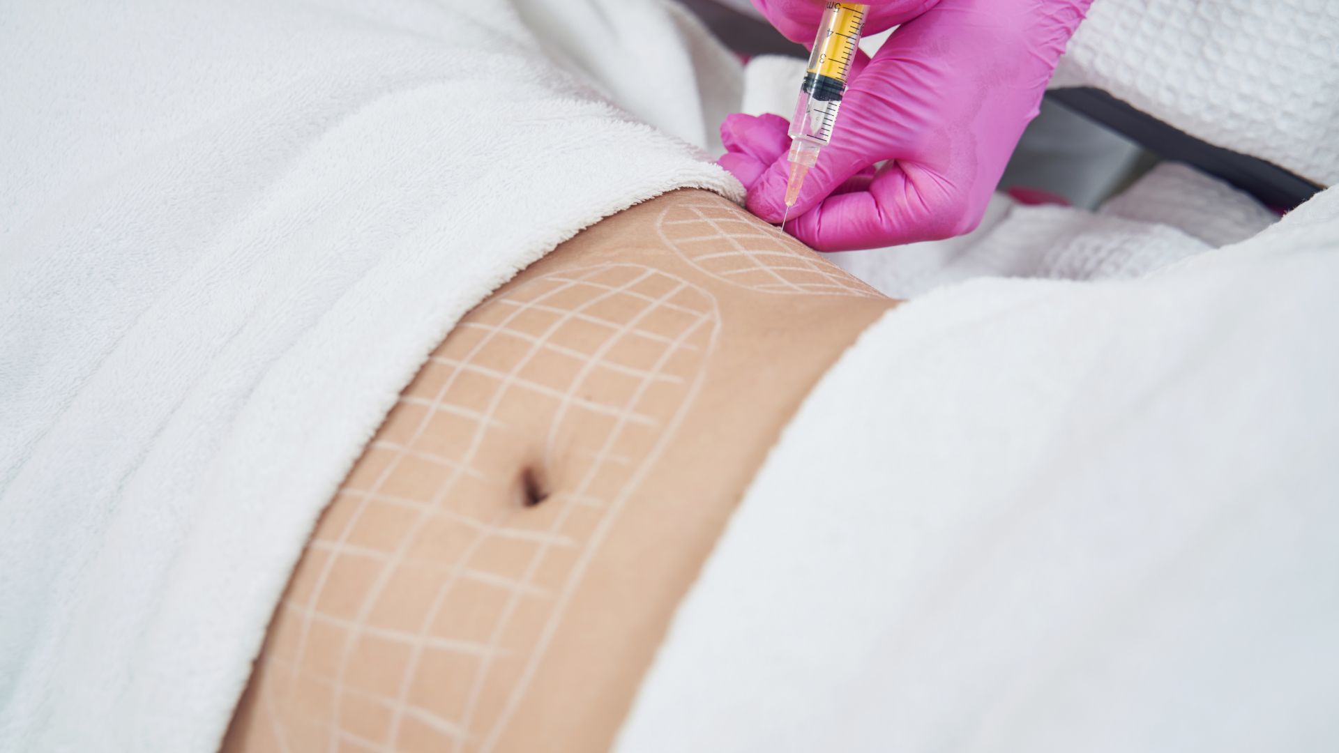 Preparación intervención abdomen