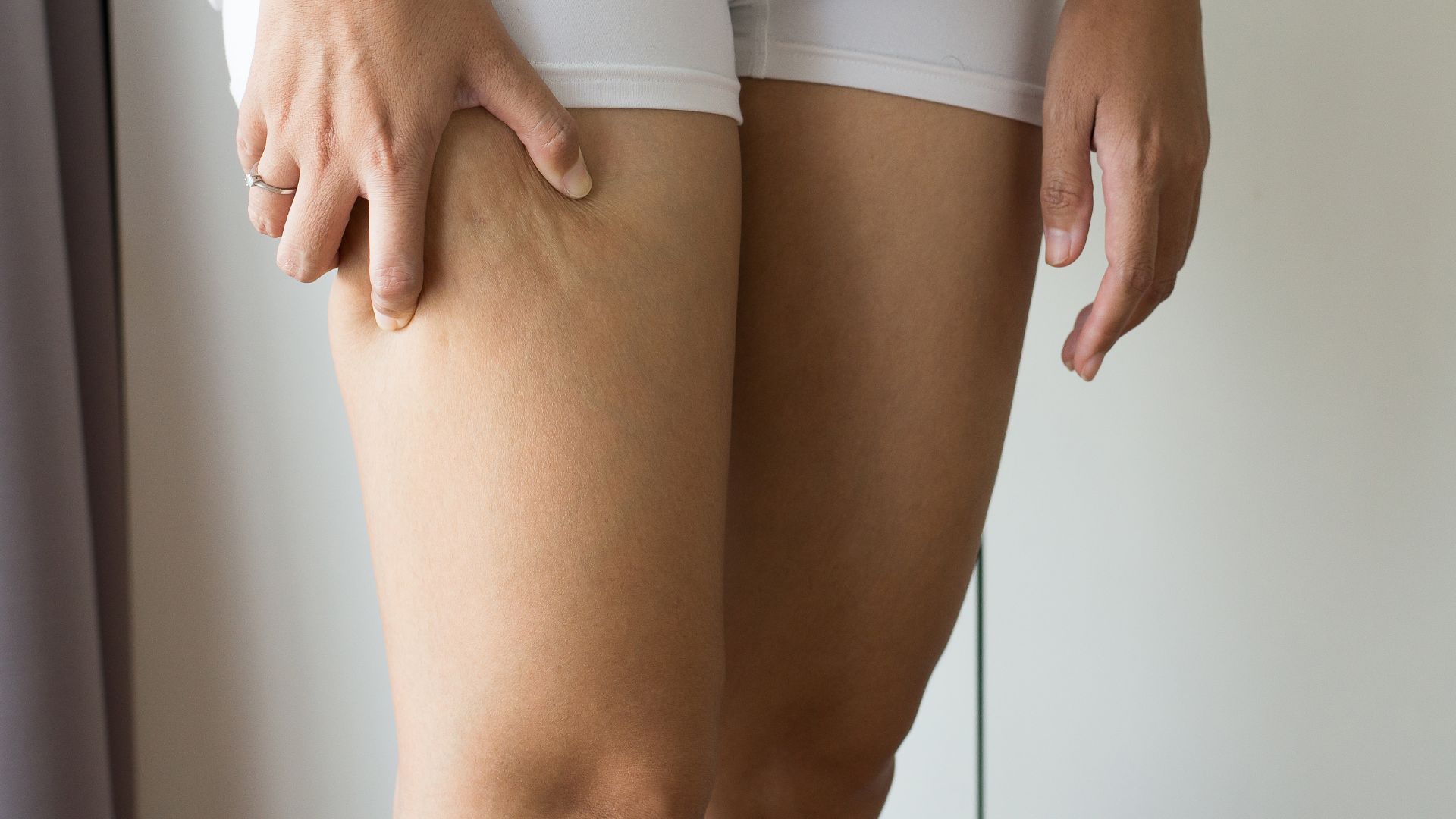 Adios a la celulitis antes del verano