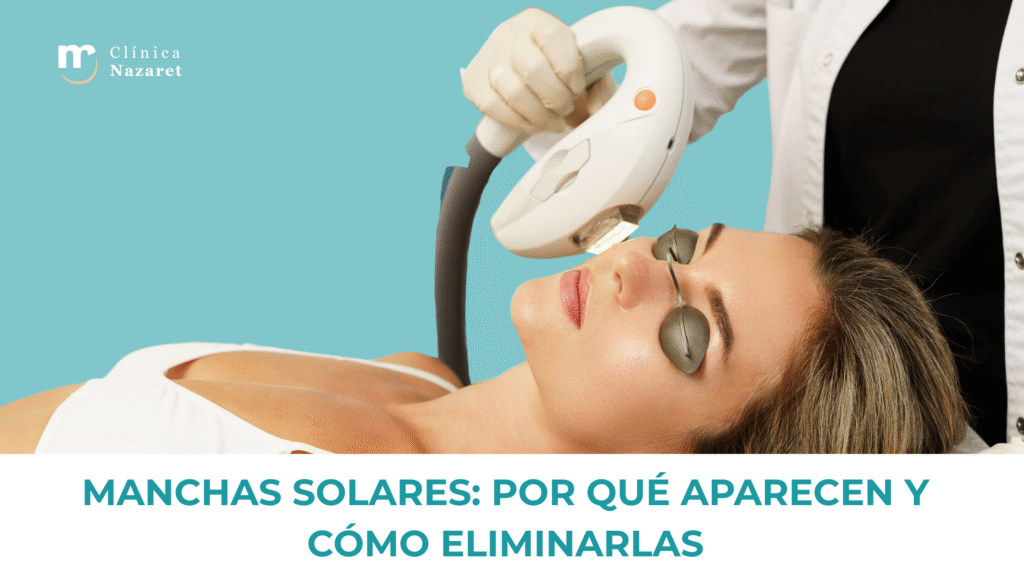 Mujer recibiendo tratamiento facial con luz pulsada para eliminar manchas solares en Clínica Nazaret.