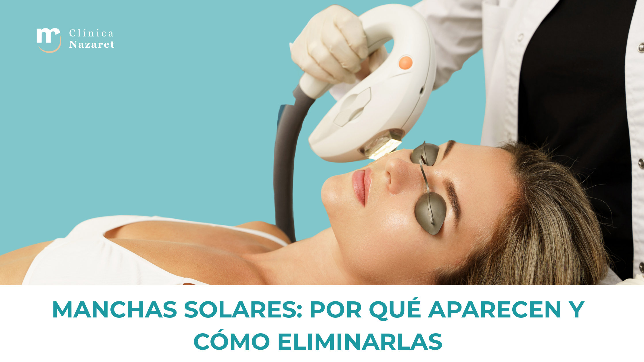 Mujer recibiendo tratamiento facial con luz pulsada para eliminar manchas solares en Clínica Nazaret.