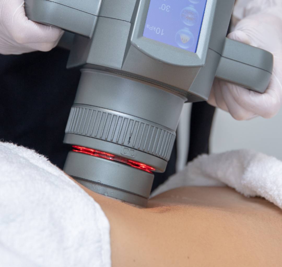 Celulitis Tratamientos con aparatología