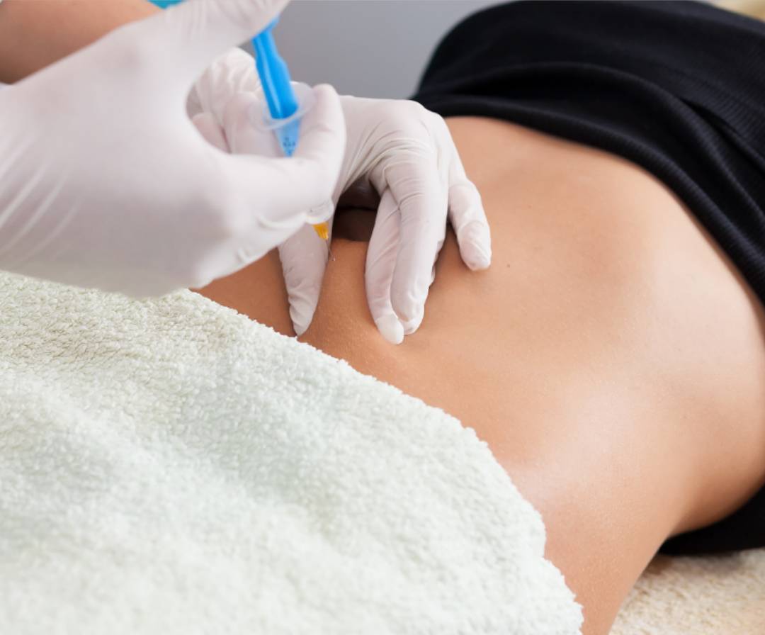 Flacidez corporal Tratamientos con inyectables